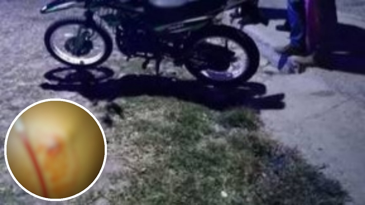 Joven agredida por presunto mototaxista (2)