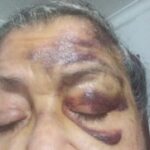 Atracadores propinaron golpiza a abuelita en Santa Marta: “Solo llevaba $3.000, unas estampitas y un rosario”