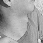 Joven fue asesinado a bala en el barrio Renacer de Soledad