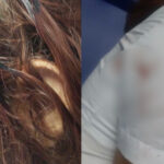 “Ella forcejeó y él la golpeó en la cabeza”: joven resultó herida durante atraco en estación de Transmetro