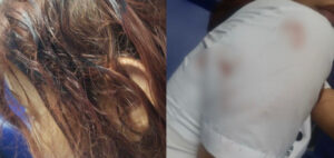 “Ella forcejeó y él la golpeó en la cabeza”: joven resultó herida durante atraco en estación de Transmetro