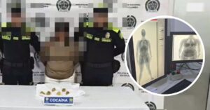 (Video) Capturada en aeropuerto de Cartagena mujer que llevaba cerca de 2 kilos de cocaína en el estómago