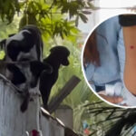 “El canino se le zafó a la señora y me mordió”: mujer que fue atacada por un perro en el norte de Barranquilla