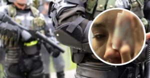 Condenado patrullero del antiguo Esmad que le ocasionó la pérdida de un ojo a joven universitaria