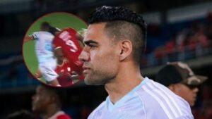 A Millonarios le tocará volver a esperar por Falcao: sufrió fractura de pómulo en duelo ante América