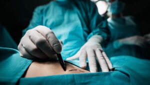 Otra presunta muerte de una mujer después de un procedimiento estético en Barranquilla: ¡laboraba como fiscal especializada!