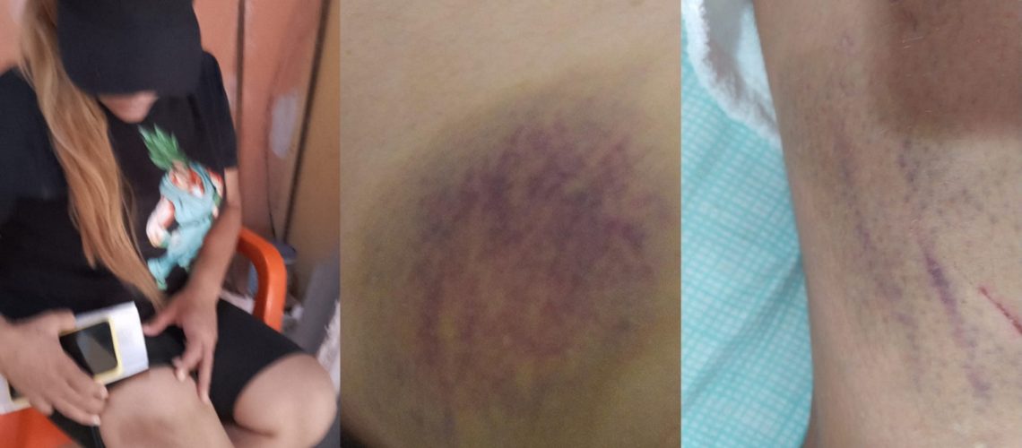 Accidente entre motocicleta y bus en La Paz (9)