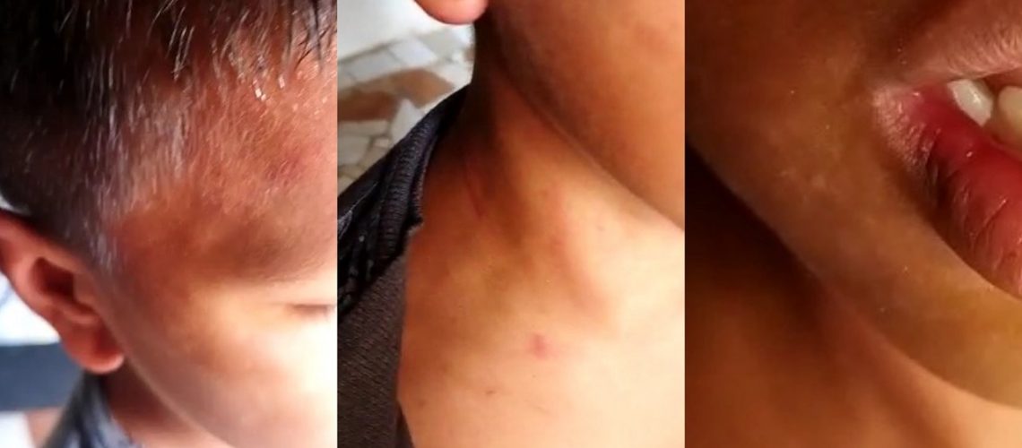 Agresión contra menor en el barrio Carlos Meisel