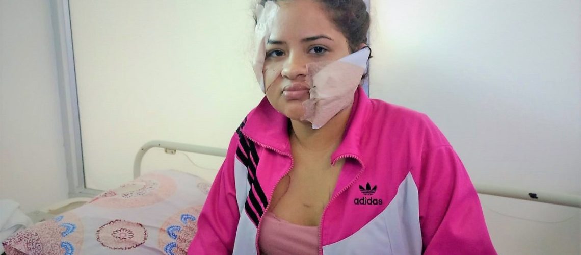 Agresión rostro chuchilla Las Malvinas Barranquilla (2)