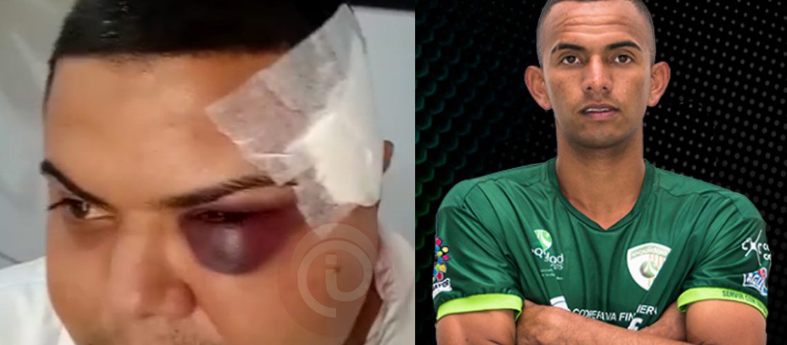Agresión jugador La Equidad3