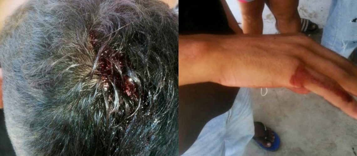 Denuncia presunto abuso policial (1)