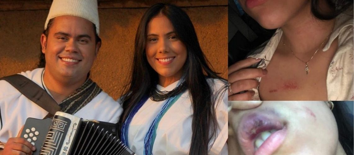 Denuncian-al-acordeonero-Jose-Ricardo-Villafane-por-lesiones-personales