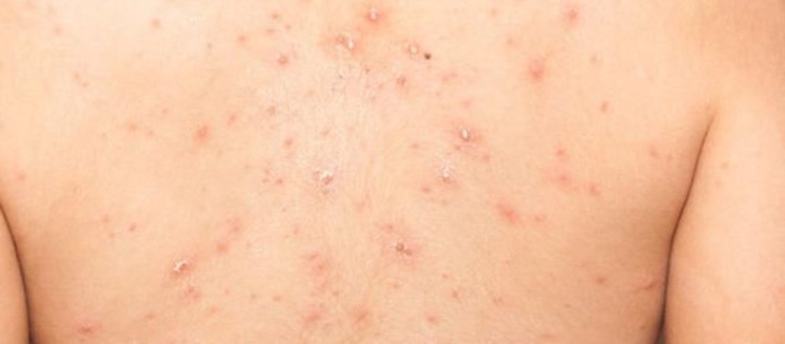 F026B1E3-C7E8-45B8-8DEC-9E7B13183EED