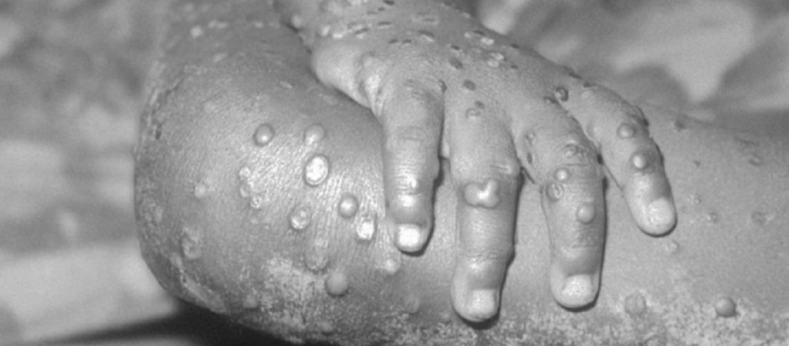 F5C61AE3-E820-49E5-B2F5-C2999F93F6C9