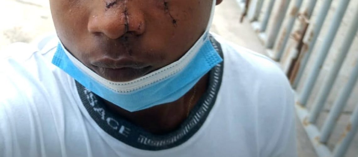 Herido riña La Sierrita (2)
