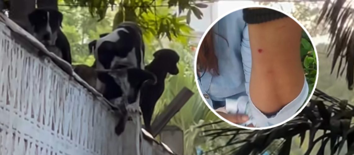 Mujer que fue atacada por perros de las señoras de los gatos en el norte de Barranquilla