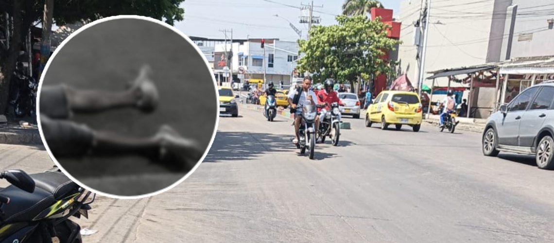 Homicido presunto atracador barrio El Bosque
