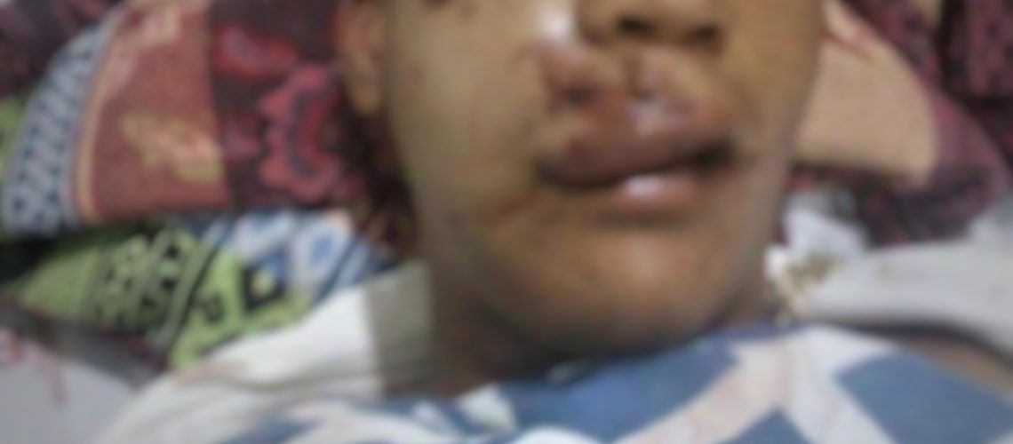 Joven agredido en Las Américas (2)-01