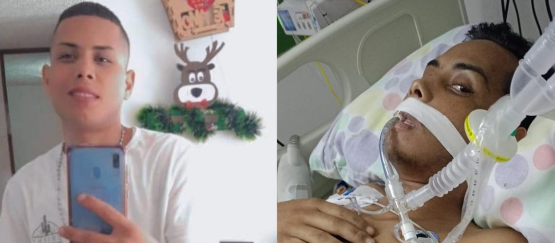 Joven trasplante intestino delgado Barranquilla