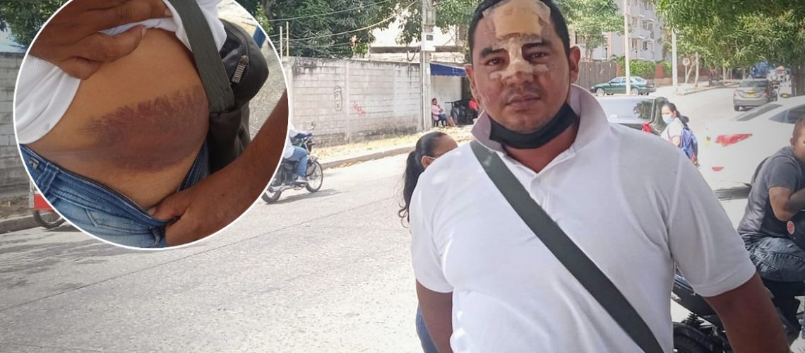 Mensajero Accidentado