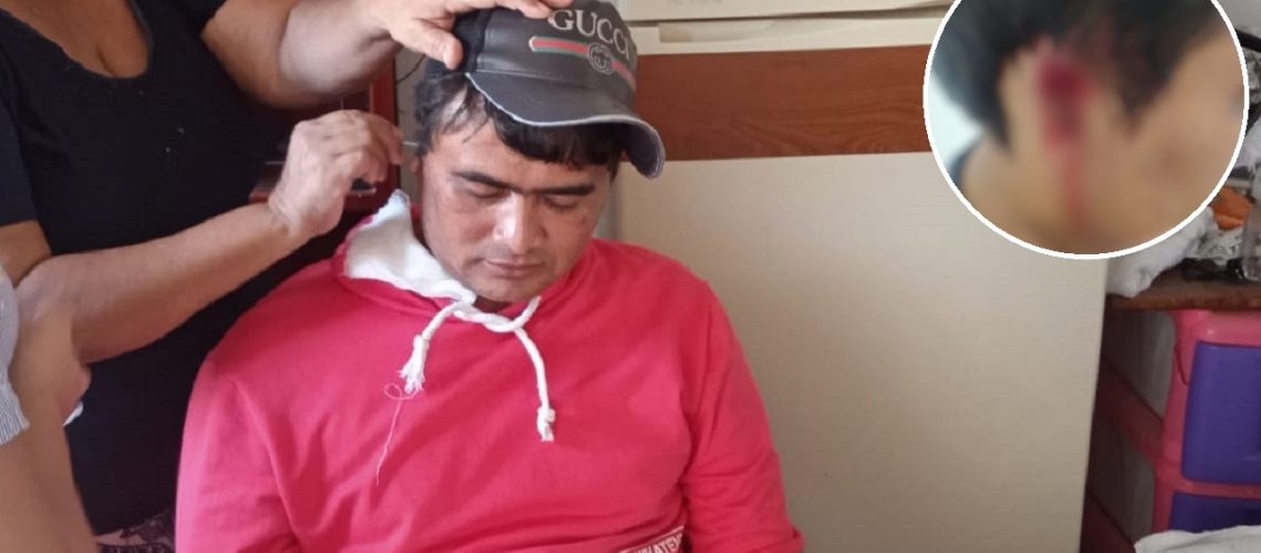 Mototaxista le arrancó la oreja a otro DESTACADA