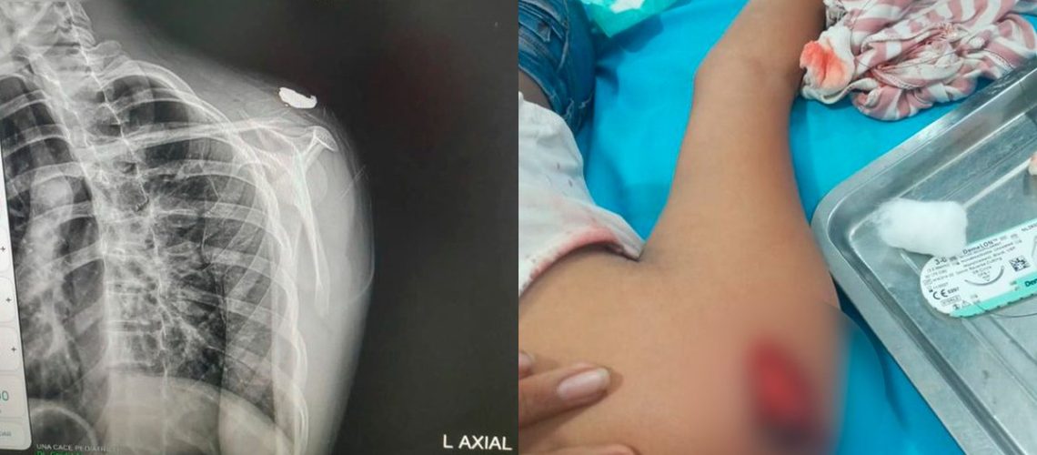 Niña bala Galapa