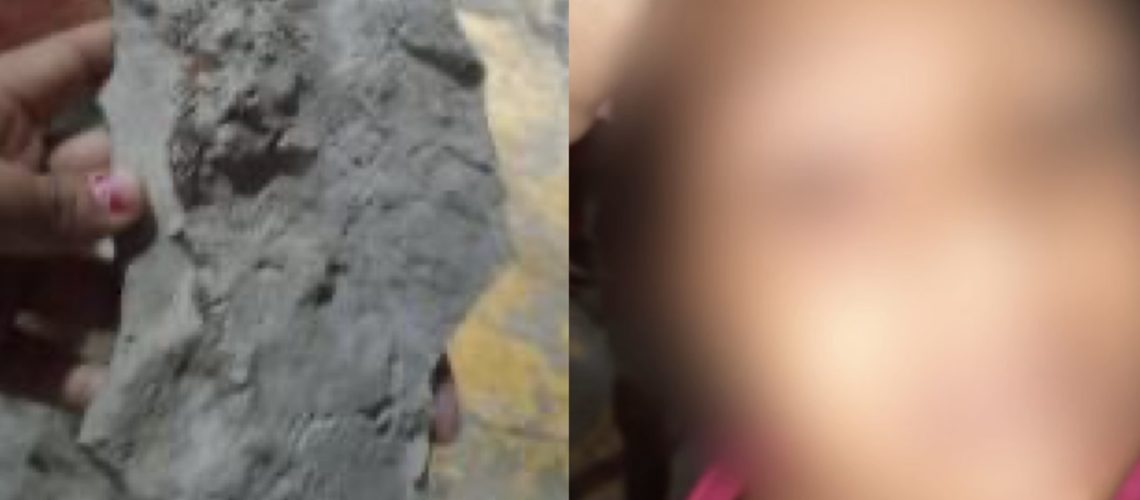 Niña golpeada piedra Santa María