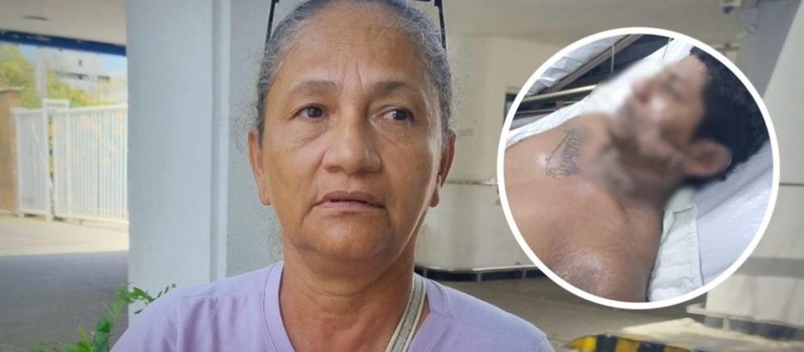 Prenden fuego a hombre para robarle la moto San Roque