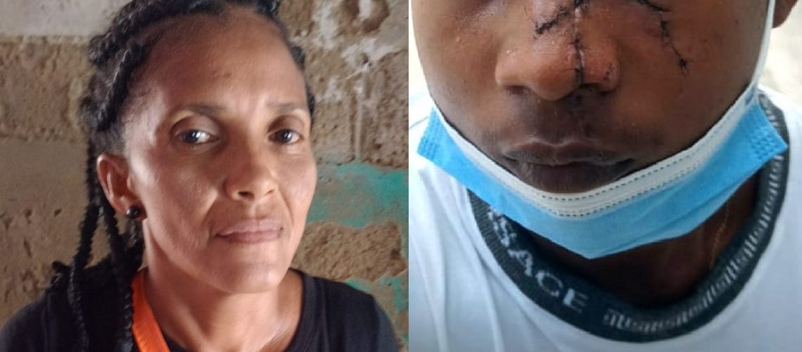 Riña La Sierrita herido rostro