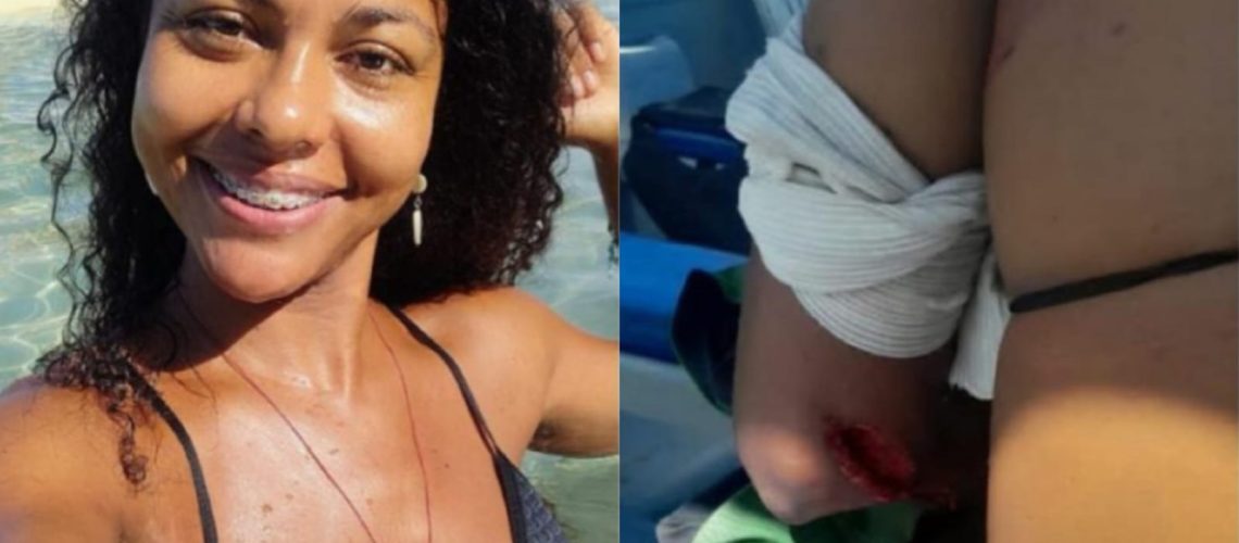 Turista herida en Barú por yate