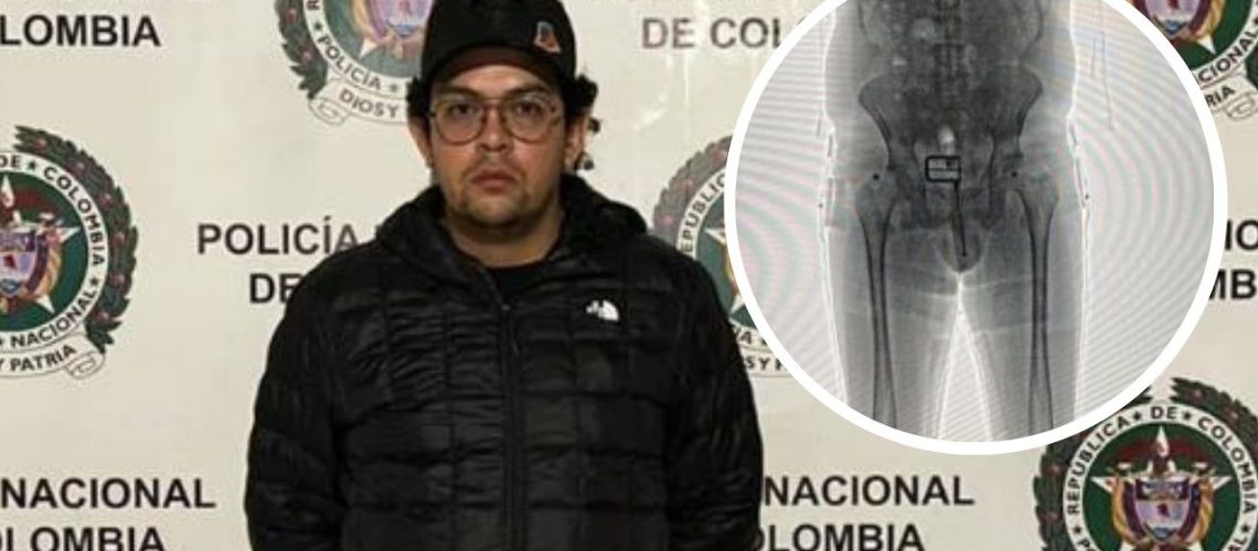 captura de hombre con dolares en sus partes intimas