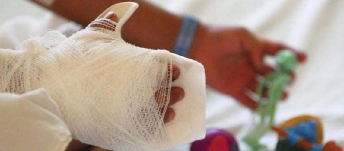 quemados en el atlantico